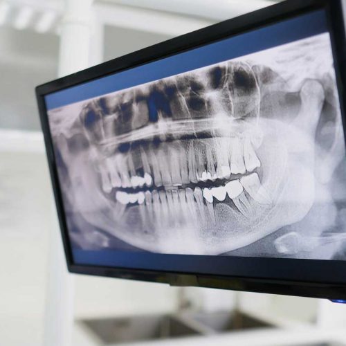 Щелепно-лицева хірургія