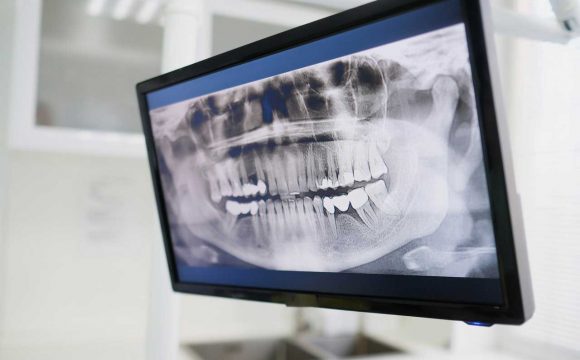 Щелепно-лицева хірургія