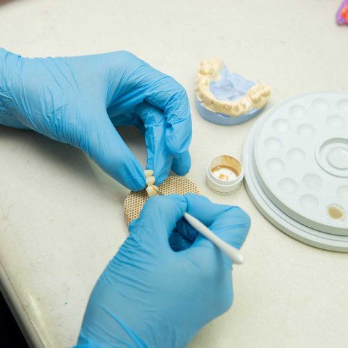 Протезування