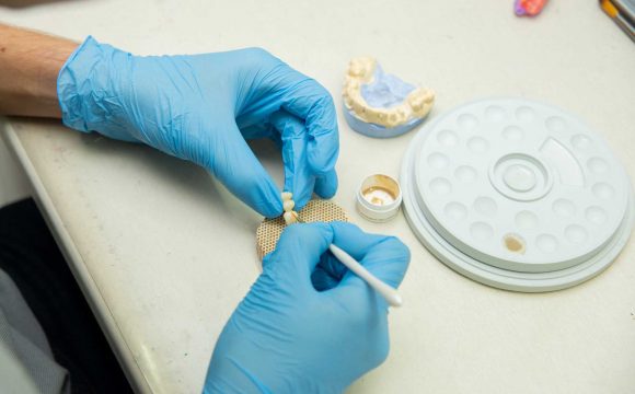 Протезування